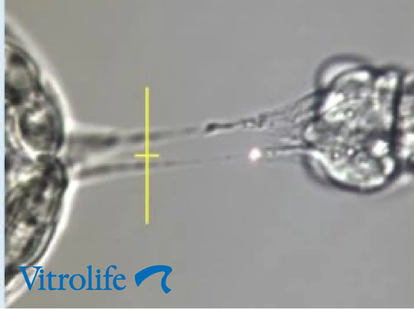Vitrolife Laser & imaging systems